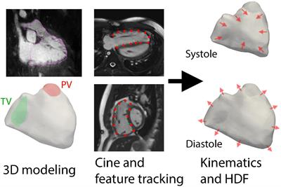 Abnormal Diastolic Hemodynamic Forces: A Link Between Right Ventricular Wall Motion, Intracardiac Flow, and Pulmonary Regurgitation in Repaired Tetralogy of Fallot